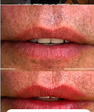 Micropigmentação e Dermopigmentação Estética Labial por Gisele de Paulo